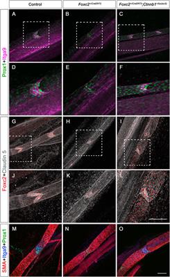 Pharmacological inhibition of FOXO1 promotes lymphatic valve growth in a congenital lymphedema mouse model